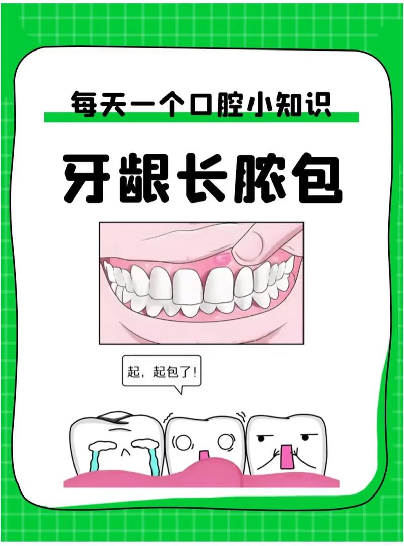 孕期牙龈瘘管能治吗?治疗会不会影响胎儿?安全处理方法有哪些?-第2张图片-郑州医学网 孕期牙龈瘘管能治吗?治疗会不会影响胎儿?安全处理方法有哪些?-第2张图片-郑州医学网