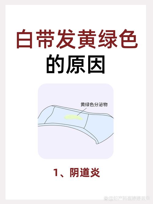 新生儿白带发黄是正常现象吗?需要就医检查吗?-第3张图片-郑州医学网 新生儿白带发黄是正常现象吗?需要就医检查吗?-第3张图片-郑州医学网