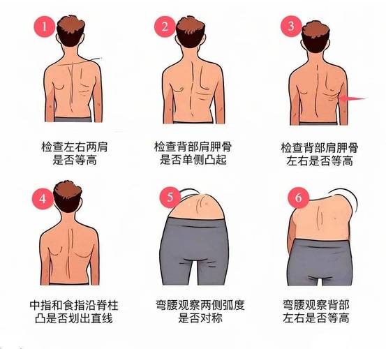 儿童肩胛骨突出是缺钙还是姿势问题?家长该如何科学应对?-第1张图片-郑州医学网 儿童肩胛骨突出是缺钙还是姿势问题?家长该如何科学应对?-第1张图片-郑州医学网