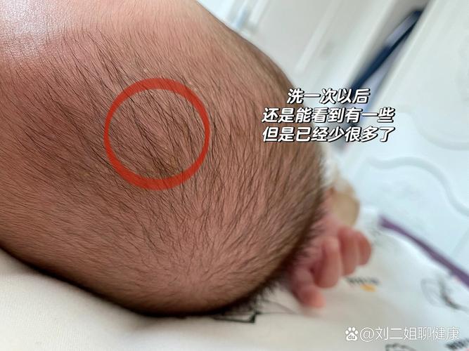 新生儿宝宝身上的胎脂需要清理吗？有什么作用和注意事项？-第1张图片-郑州医学网