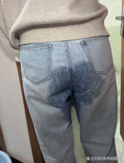 孕期打个喷嚏都尿裤子-第1张图片-郑州医学网 孕期打个喷嚏都尿裤子-第1张图片-郑州医学网