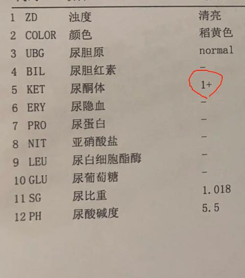 孕期尿检酮体3个加号是什么原因？对胎儿有影响吗？需要怎么处理？-第1张图片-郑州医学网