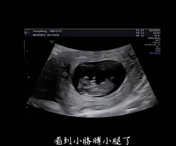 孕期B超检查次数有标准吗？不同孕周该做几次？-第2张图片-郑州医学网