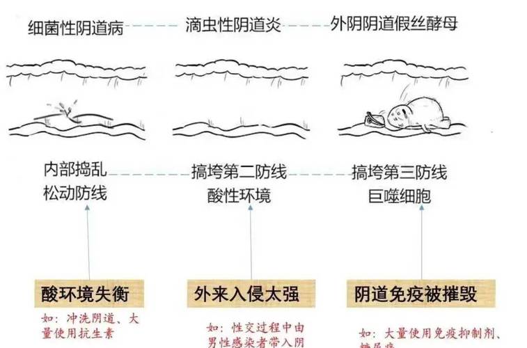 儿童外阴炎怎么治？日常护理和药物选择哪个更关键？-第3张图片-郑州医学网