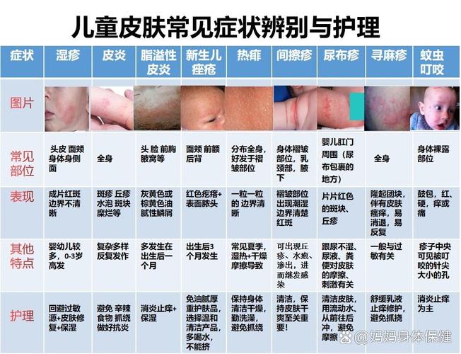 儿童皮肤病辨别图片能准确区分常见皮疹类型吗？家长如何避免误判？-第2张图片-郑州医学网