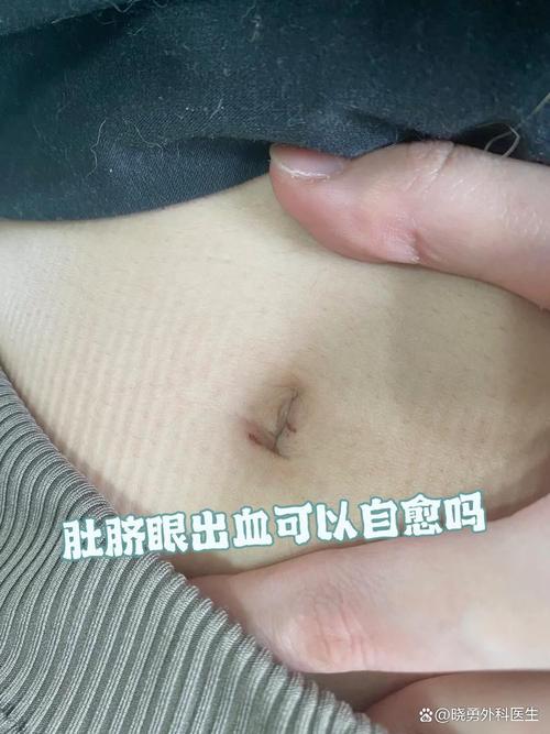 初孕小腹阵痛出血是先兆流产吗？需要立即就医吗？-第2张图片-郑州医学网