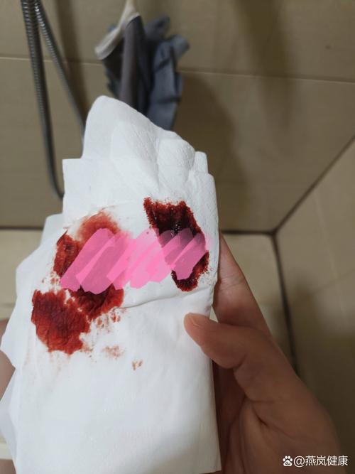 初孕小腹阵痛出血是先兆流产吗？需要立即就医吗？-第3张图片-郑州医学网