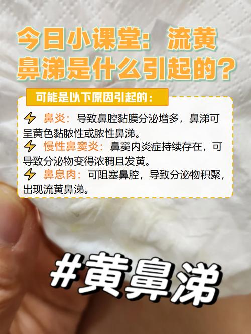儿童黄鼻涕是感冒还是细菌感染？不同颜色鼻涕预示哪些健康问题？-第2张图片-郑州医学网