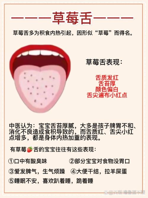儿童草莓舌的出现是哪些疾病在作祟？需要家长警惕哪些潜在健康问题？-第2张图片-郑州医学网