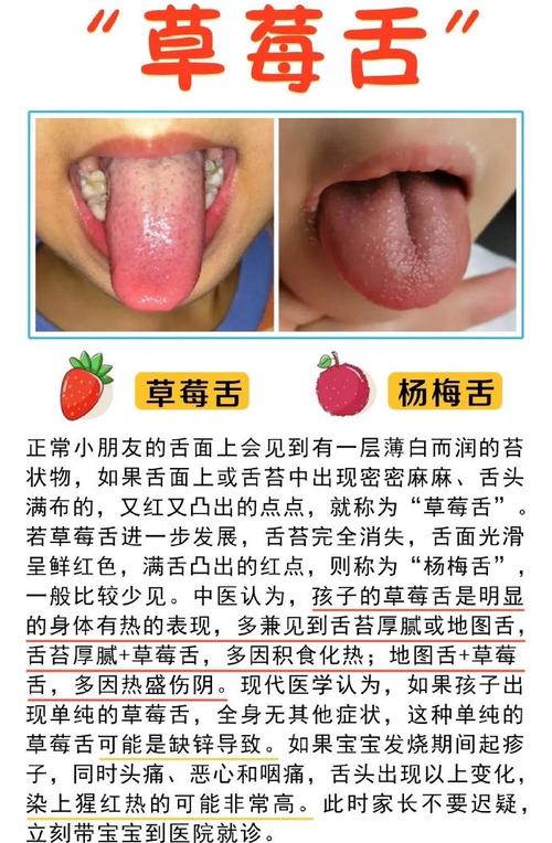 儿童草莓舌的出现是哪些疾病在作祟？需要家长警惕哪些潜在健康问题？-第1张图片-郑州医学网
