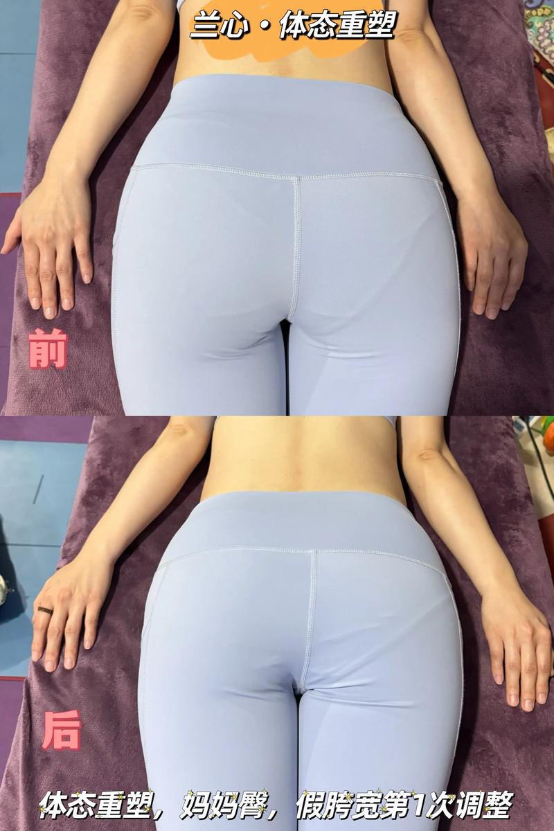 孕期屁股变大生后能自然恢复吗？需怎么锻炼和饮食调整？-第1张图片-郑州医学网