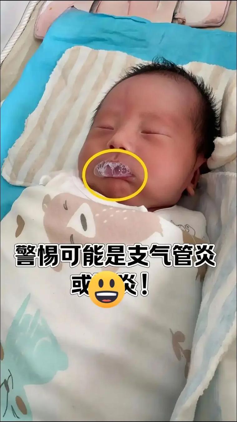 新生儿胀气真的会吐泡泡吗?背后可能隐藏哪些健康信号?-第2张图片-郑州医学网 新生儿胀气真的会吐泡泡吗?背后可能隐藏哪些健康信号?-第2张图片-郑州医学网