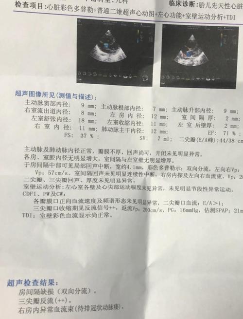 新生儿小房缺是什么原因导致的？需要治疗吗？会影响宝宝发育吗？-第1张图片-郑州医学网