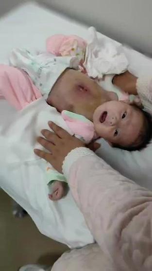 新生儿哭时全身发紫是窒息信号还是正常生理反应？-第3张图片-郑州医学网