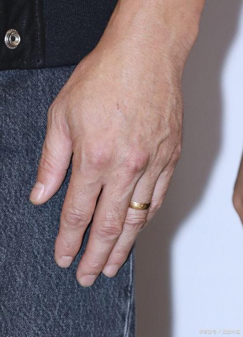 孕期手背青筋突然暴起是正常生理变化还是异常信号？需警惕哪些潜在风险？-第3张图片-郑州医学网