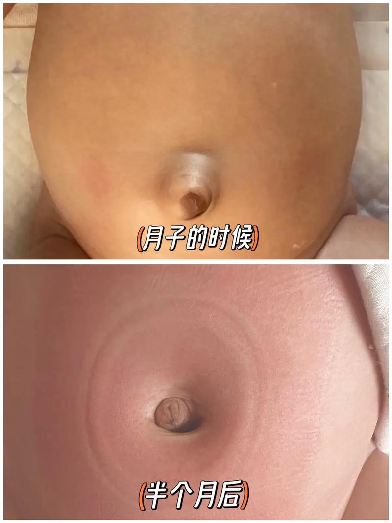 孕期肚脐什么时候突出-第3张图片-郑州医学网