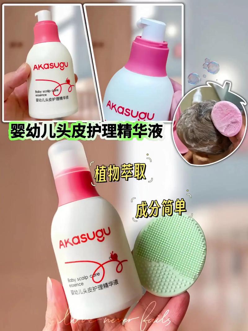 儿童头上湿疹反复发作，日常护理和用药该如何科学应对？-第3张图片-郑州医学网