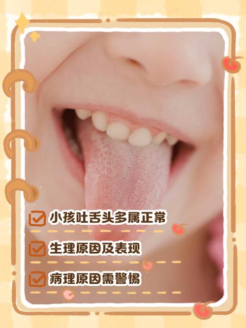 新生儿舌头大是正常现象还是疾病信号?需警惕哪些潜在问题?-第1张图片-郑州医学网 新生儿舌头大是正常现象还是疾病信号?需警惕哪些潜在问题?-第1张图片-郑州医学网