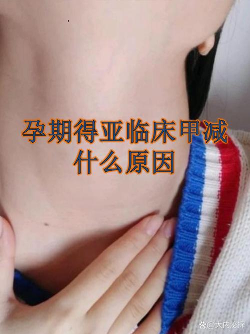 孕期甲减对孩子的影响-第1张图片-郑州医学网 孕期甲减对孩子的影响-第1张图片-郑州医学网