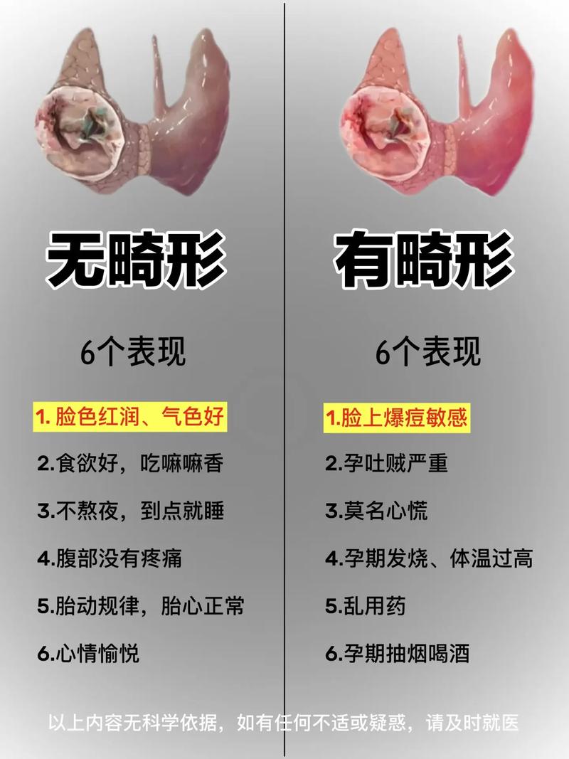 孕期甲减对孩子的影响-第3张图片-郑州医学网