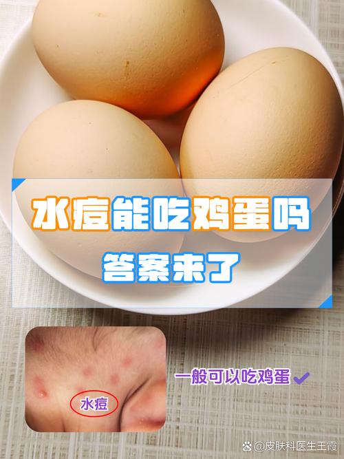 儿童出水痘期间饮食该注意什么？哪些食物能促进恢复？-第3张图片-郑州医学网