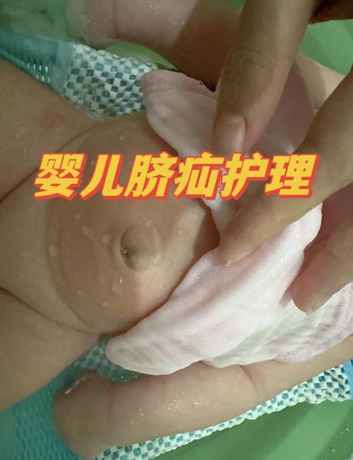 4岁儿童疝气必须手术吗？有哪些非手术治疗方法可选？-第1张图片-郑州医学网