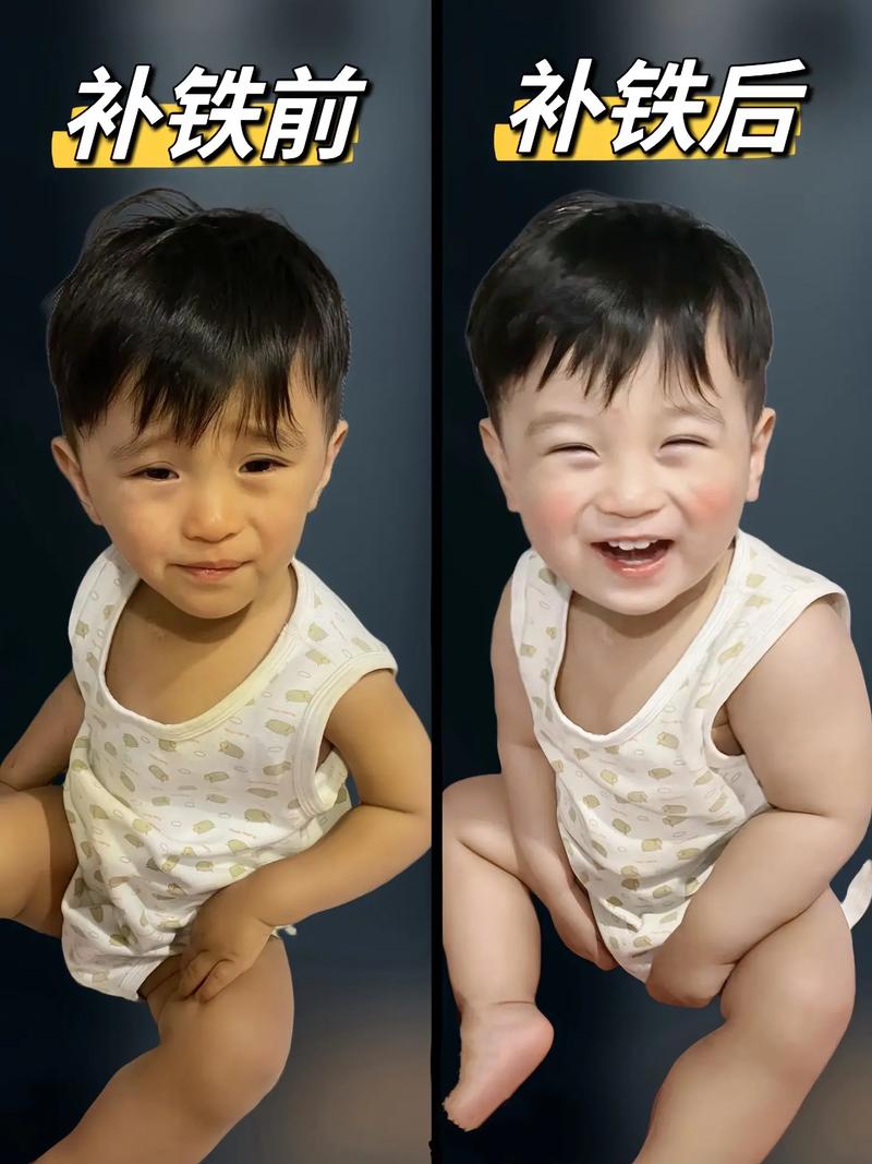 儿童皮肤发黄是营养不良还是肝脏疾病信号?需警惕哪些潜在原因?-第3张图片-郑州医学网 儿童皮肤发黄是营养不良还是肝脏疾病信号?需警惕哪些潜在原因?-第3张图片-郑州医学网