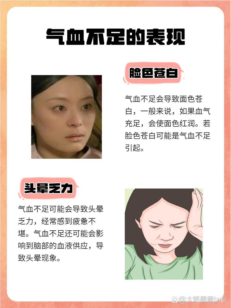 孕期脸色苍白是贫血信号？孕期脸色苍白怎么调理才安全有效？-第1张图片-郑州医学网