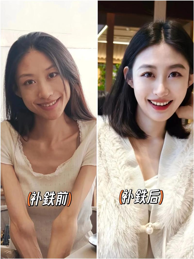 孕期脸色苍白是贫血信号？孕期脸色苍白怎么调理才安全有效？-第2张图片-郑州医学网