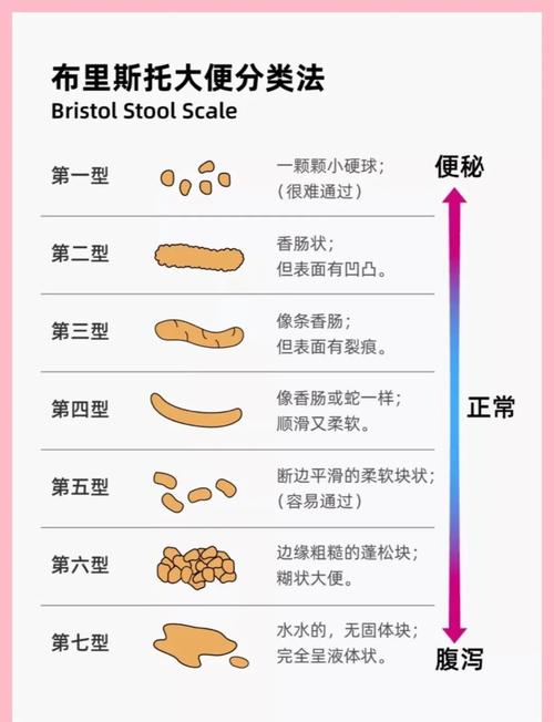 新生儿拉完屎必须马上换吗?不及时换会有什么影响?-第3张图片-郑州医学网 新生儿拉完屎必须马上换吗?不及时换会有什么影响?-第3张图片-郑州医学网