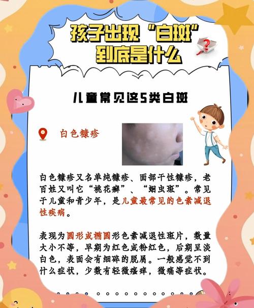 儿童脸上长斑是什么原因？该如何科学有效解决？-第2张图片-郑州医学网