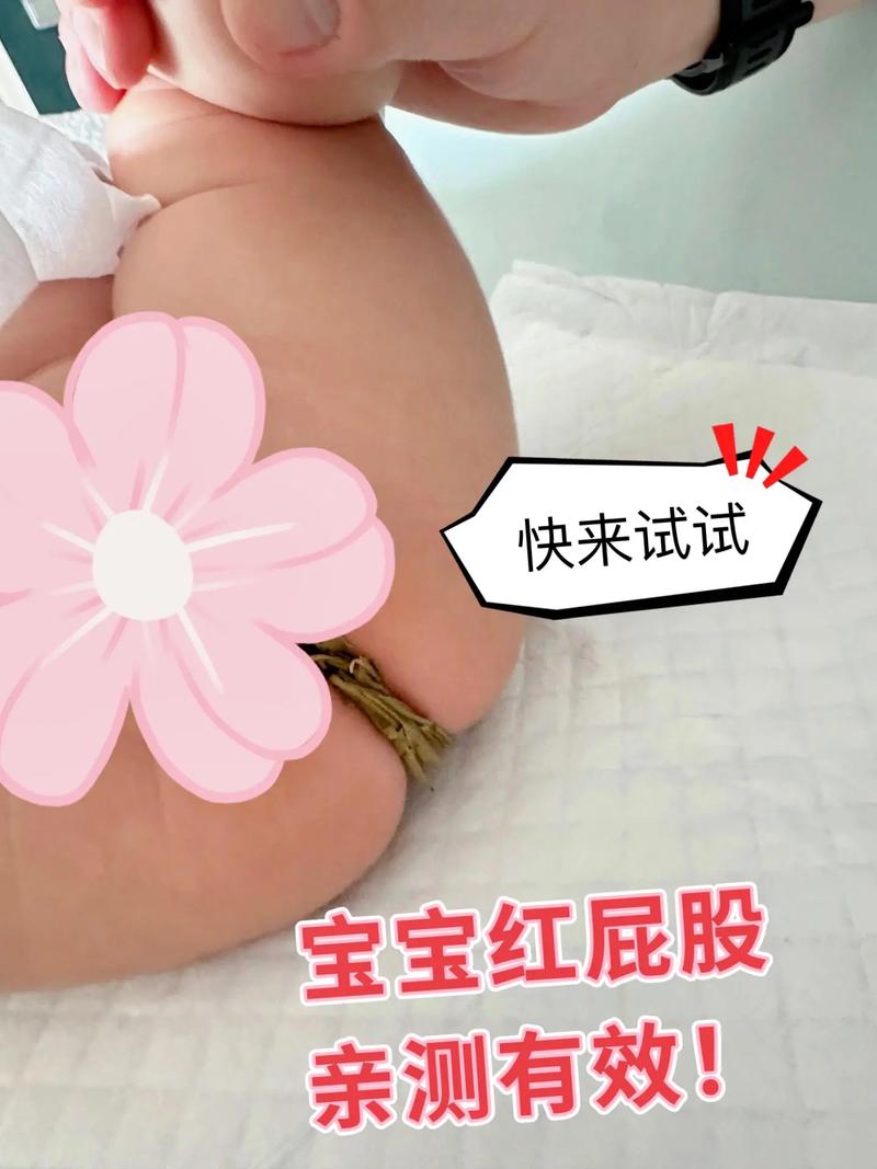 新生儿屁股左右不对称是发育异常还是正常生理差异?-第1张图片-郑州医学网 新生儿屁股左右不对称是发育异常还是正常生理差异?-第1张图片-郑州医学网