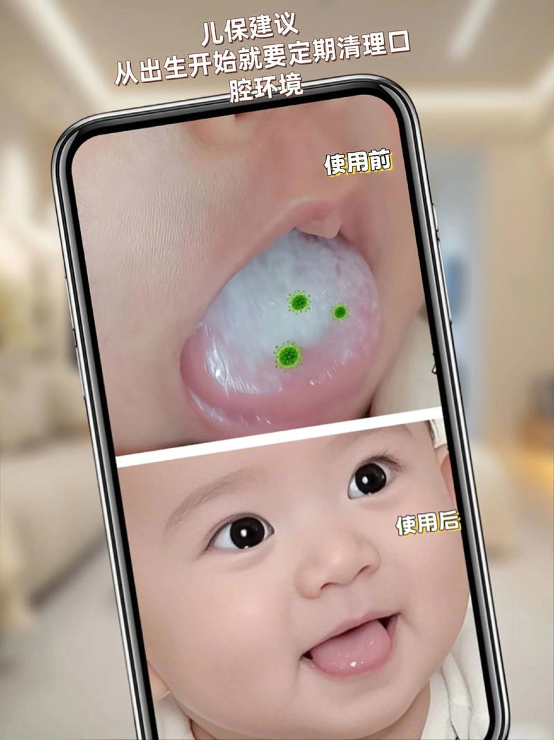 新生儿舌苔白厚正常吗-第1张图片-郑州医学网