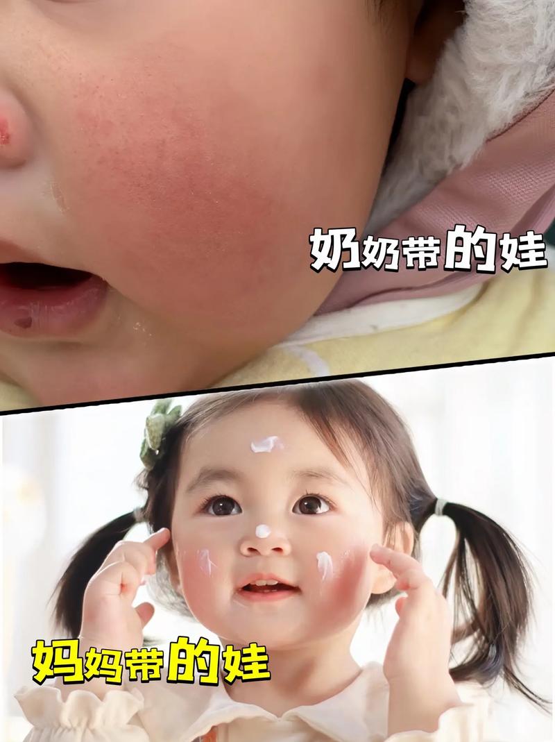 新生儿用奶水擦脸真的好吗？会不会引发皮肤问题？-第1张图片-郑州医学网