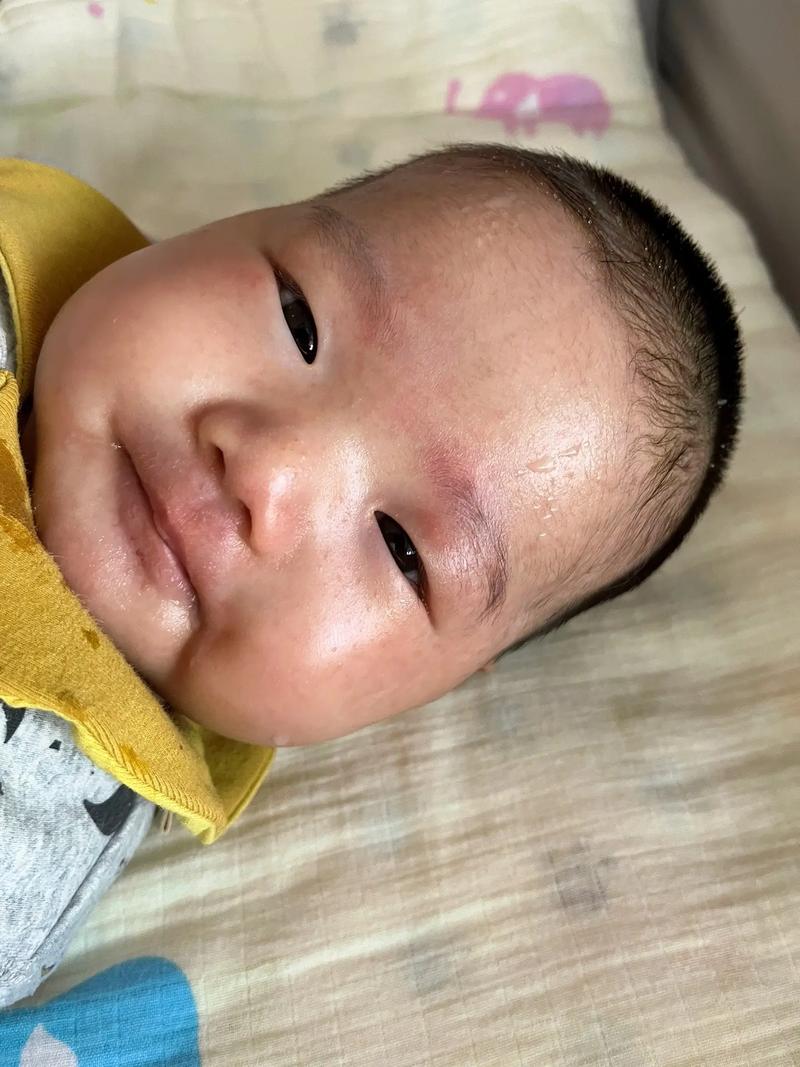 新生儿用奶水擦脸真的好吗？会不会引发皮肤问题？-第2张图片-郑州医学网