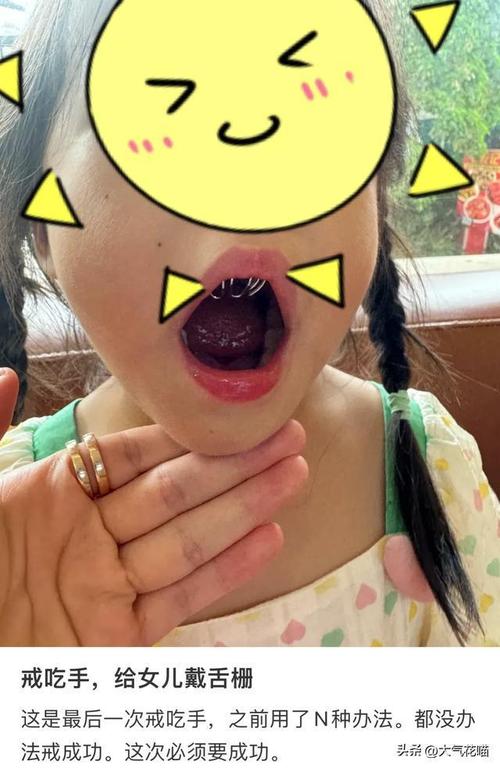 儿童咬指甲的恐怖图片-第1张图片-郑州医学网