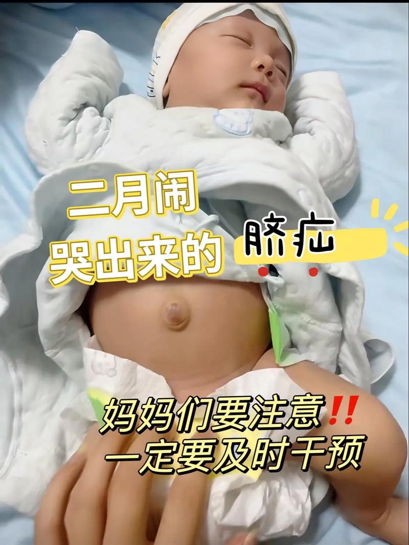 新生儿频繁哭闹会导致疝气吗?哭闹与疝气之间究竟存在怎样的关联?-第2张图片-郑州医学网 新生儿频繁哭闹会导致疝气吗?哭闹与疝气之间究竟存在怎样的关联?-第2张图片-郑州医学网