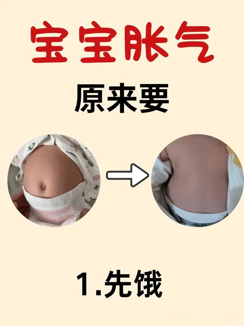 新生儿肚子软就是胀气吗？哪些信号需警惕？-第1张图片-郑州医学网