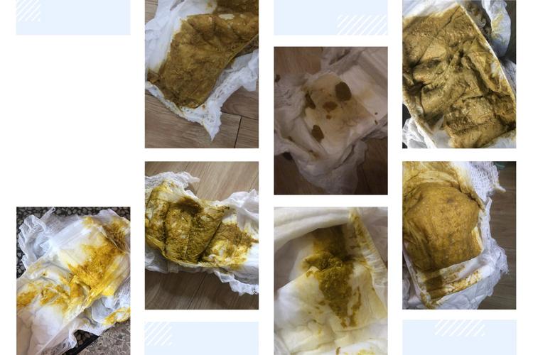 母乳喂养新生儿长时间不排便究竟正常还是异常？-第2张图片-郑州医学网