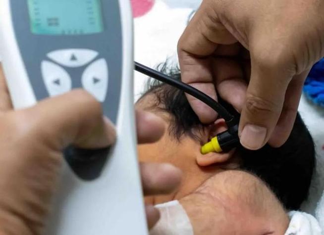 新生儿耳聋筛查未通过，宝宝听力异常怎么办？后续干预该怎么做？-第2张图片-郑州医学网