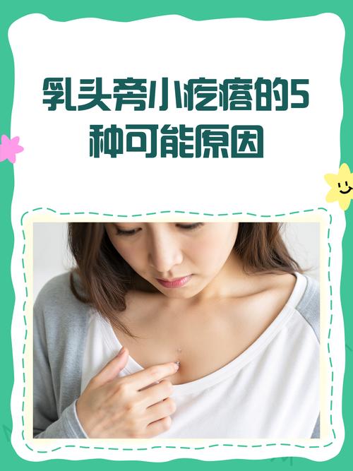 孕期乳头上长了小疙瘩是正常的吗？需要担心吗？-第3张图片-郑州医学网