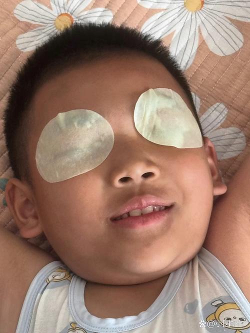 儿童做后巩膜加固术安全吗？效果能维持多久？有没有更优的近视控制方案？-第1张图片-郑州医学网