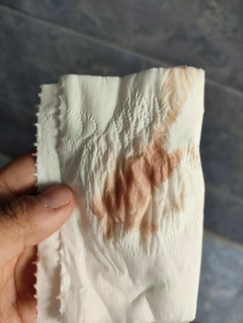 孕期宫颈糜烂出血，是正常现象还是危险信号？-第2张图片-郑州医学网