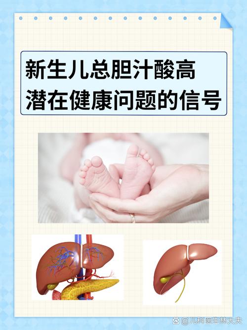 新生儿总胆汁酸高怎么治？需要住院吗？会转成肝炎吗？-第1张图片-郑州医学网