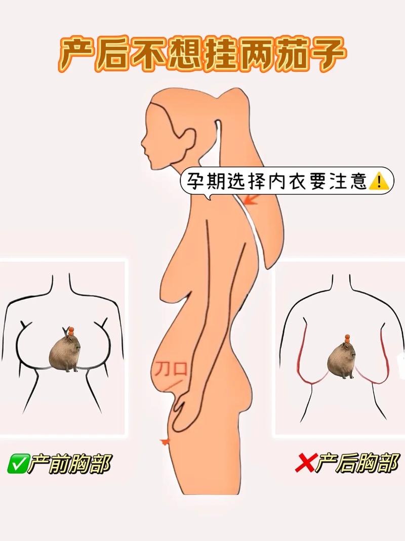 孕期如何有效预防乳房下垂？关键护理措施有哪些？-第2张图片-郑州医学网