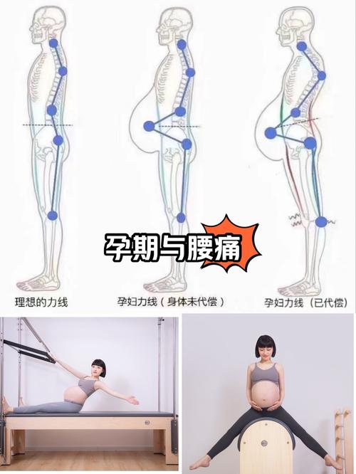 孕期背部疼痛难忍？有哪些安全有效的缓解方法？-第3张图片-郑州医学网