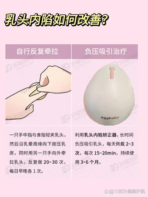 孕期如何有效预防乳头内陷？关键护理措施有哪些？-第1张图片-郑州医学网