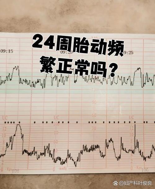 孕期胎动幅度不大，是宝宝发育迟缓还是个体差异？需要警惕哪些异常信号？-第1张图片-郑州医学网