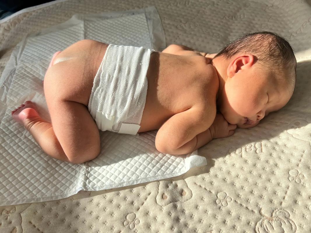 新生儿冬天晒黄疸,隔着玻璃晒有效吗?要注意哪些细节才能退黄?-第3张图片-郑州医学网 新生儿冬天晒黄疸,隔着玻璃晒有效吗?要注意哪些细节才能退黄?-第3张图片-郑州医学网