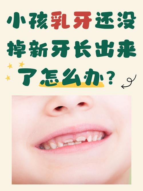 儿童换牙期恒牙未脱落就萌出，是何原因导致的？是否需要干预处理？-第2张图片-郑州医学网